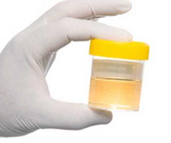 ESAME DELLE URINE
